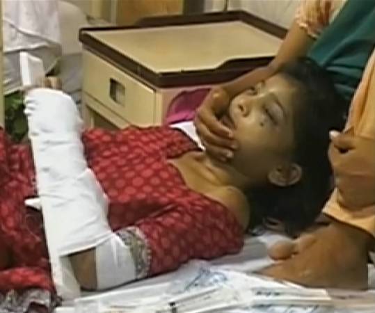بارہ سالہ گھریلوملازمہ پر مالکان کا تشدد، تشویشناک حالت میں جناح ہسپتال لاہور منتقل 
