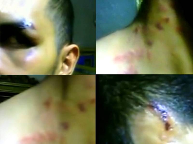 اک ”یوسف“ ہی نہیں بھائیوں کا مارا... کرکٹر ذوالقرنین حیدر پر بھائیوں کا تشدد، زخموں کی ویڈیو فیس بک پر جاری