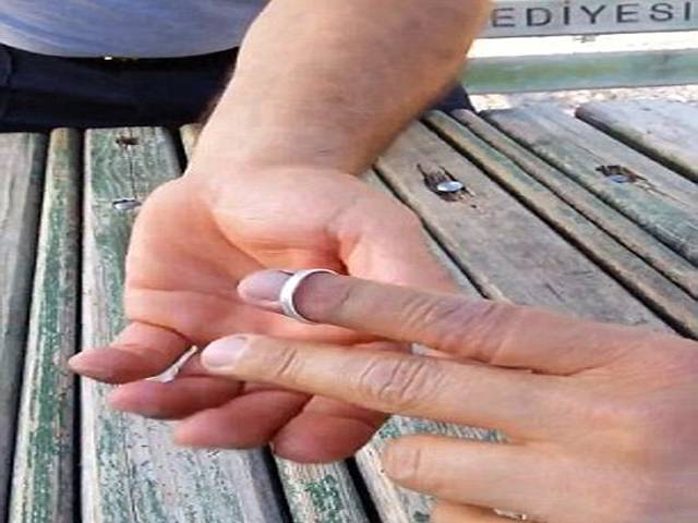 انگلی میں پھنسی انگوٹھی سے نجات پانے کا آسان طریقہ 