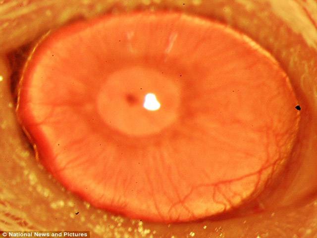 نابینا افراد کے لئے خوشخبری، سائنسدانوں نے لیبارٹری میں آنکھ اگالی