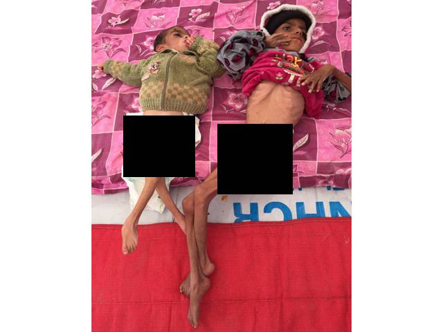 بھوک سے مرتے ان بچوں کی یہ تصویر کس اسلامی ملک سے آئی ہے؟ ایسی تلخ حقیقت کہ جان کر ہر مسلمان شرم سے پانی پانی ہوجائے