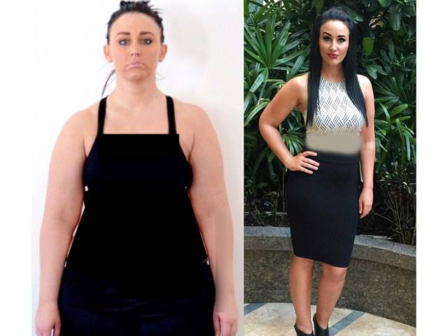 ’میرے موٹاپے کی وجہ میرے جسم میں یہ چیز تھی جس سے نجات حاصل کرتے ہی 35 کلو وزن کم ہوگیا‘ خاتون نے وزن میں اضافے کی ایسی وجہ بتادی جس کی جانب موٹے لوگ کبھی دھیان ہی نہیں دیتے