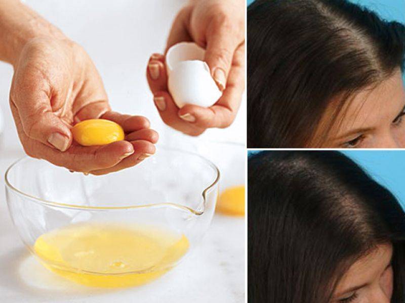 انڈے کے ذریعے گنجا ہوتا سر پھر سے بالوں سے بھرنے کا آسان قدرتی نسخہ