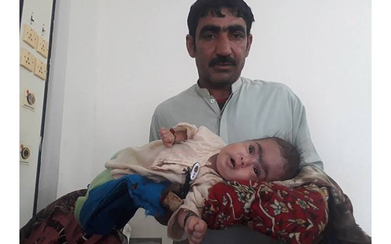پاکستانی نوزائیدہ بچی کے دماغ کے ساتھ سر سے بھی بڑی رسولی اُگ آئی، غریب ماں باپ ڈاکٹروں سے علاج کے لئے در بدر کی ٹھوکریں کھانے پر مجبور