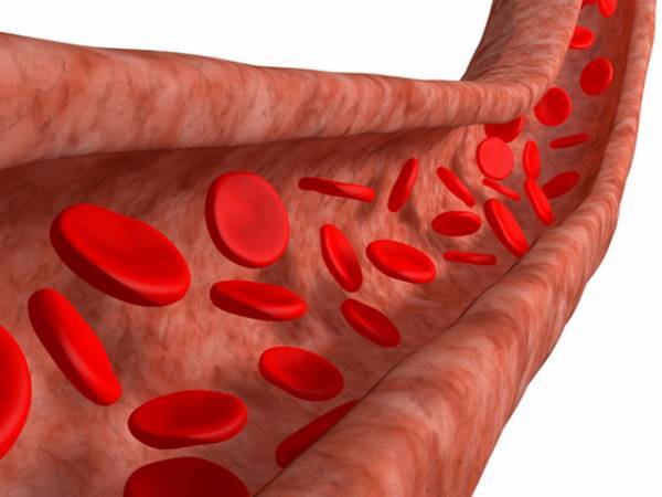 شریانوں کی صفائی اور خون کا بہاﺅ بہتر بنانے کیلئے آسان ترین قدرتی نسخہ
