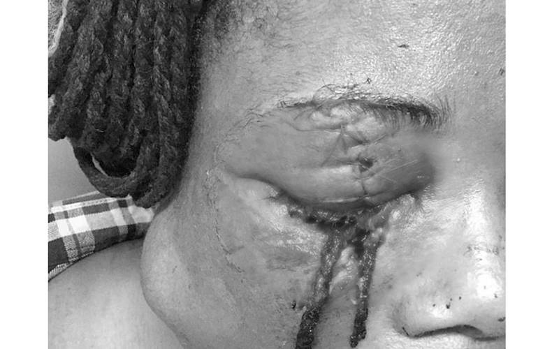 خاتون کے نقلی بال لڑائی کے دوران اس کی جلد کے اندر گھس گئے