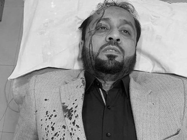مسلم لیگ ن کے رہنما اور سابق صوبائی وزیر خواجہ عمران نذیر کارحادثے میں زخمی 