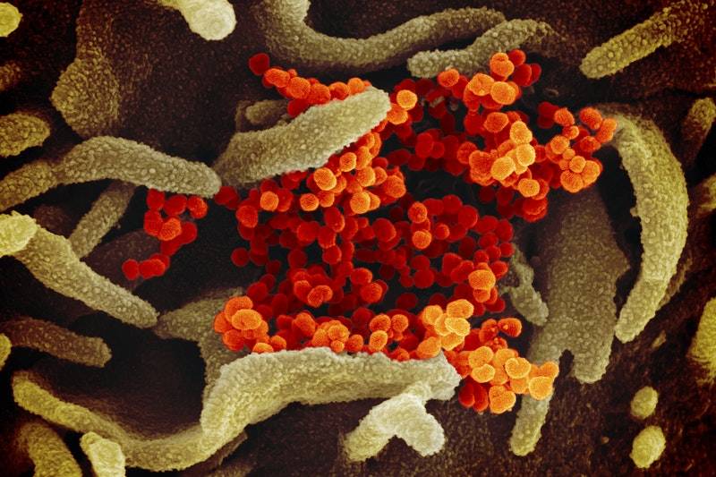 امریکا میں کوروناوائرس سے ہلاکتیں 57 ہزار کے قریب،کس ریاست میں کتنے لوگ ہلاک ہوئے؟افسوسناک اعدادوشمار جاری
