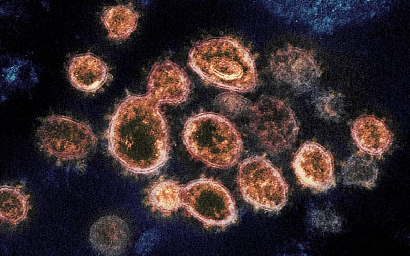 17 سال قبل سارس وائرس سے صحت یاب ہونے والے مریض کے خون کا معائنہ، سائنسدانوں کو ایسی چیز مل گئی کہ کورونا وائرس کے خلاف جنگ جیتنے کی اُمید پیدا ہوگئی