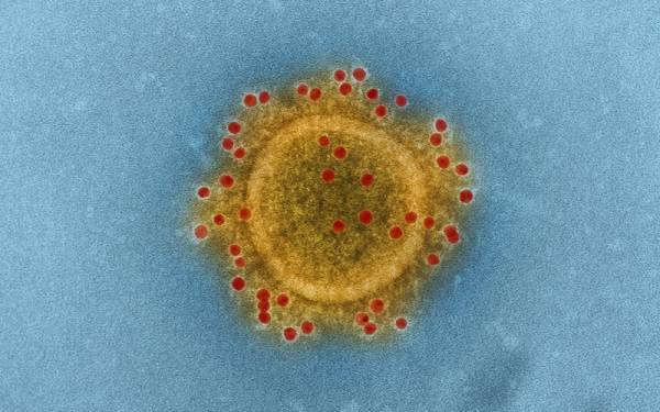 خیبرپختونخوا میں کورونا وائرس سے 14 افرادجاں بحق ہو گئے