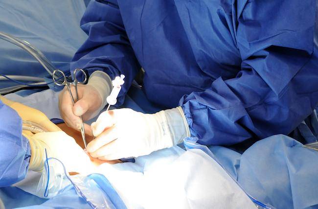 پاکستان کے شعبہ طب میں تاریخ رقم، سینہ کھولے بغیر دل کی کامیاب سرجری