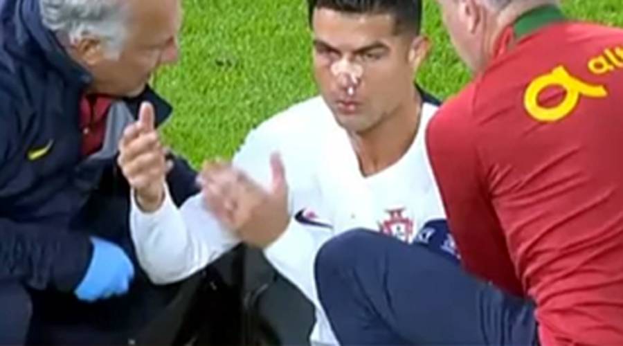 یوئیفا نیشنز لیگ میں کرسٹیانو رونالڈو کھلاڑی سے ٹکرا کر شدید زخمی ، گراؤنڈ سے باہر لے جایا گیا