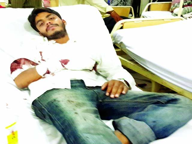 سروسیز ہسپتال گارڈوں نے نوجوان کو تشدد کا نشانہ بنا ڈالا ہاتھ کی نسیں اور پٹھے کاٹ ڈالے 
