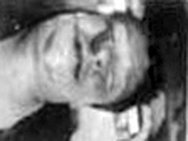  شاد با غا ، 25سا لہ نو جو ان کی شنا خت نہ ہو نے پر نعش مردہ خا نہ میں جمع