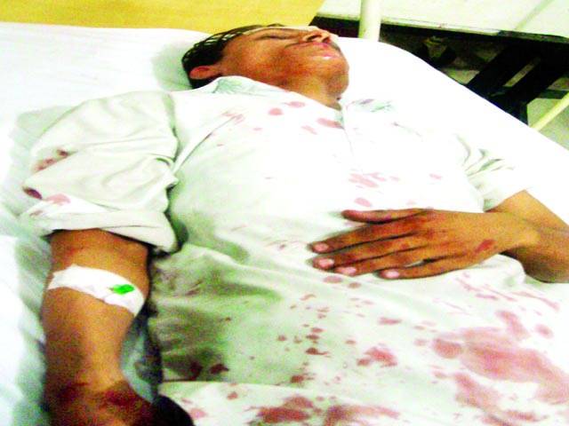  باغبانپورہ ،دوکان کی لفٹ گرنے سے 3افراد شدید زخمی ہو گئے
