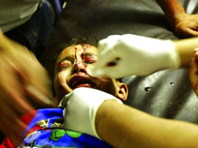 غزہ: اسرائیلی گولہ باری سے شدید زخمی بچے کو ڈاکٹر طبی امداد دے رہے ہیں