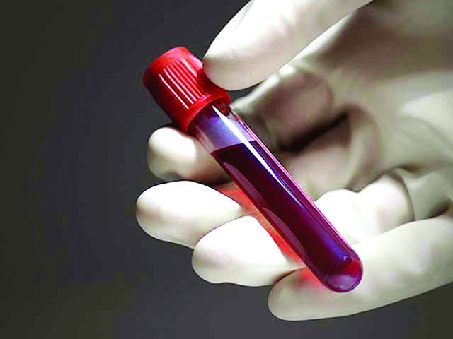  آٹزم کی درستگی سے نشاندہی کرنے والا پہلا خون ٹیسٹ